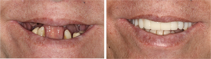 Cosmetic Dentistry in Financial District